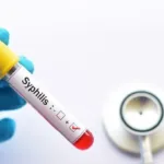 Alerta sífilis: en 2025 hubo más de 46.000 casos