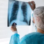 Concluyeron las medidas de cuarentena en la región rusa de Irkutsk tras la muerte de una laboratorista